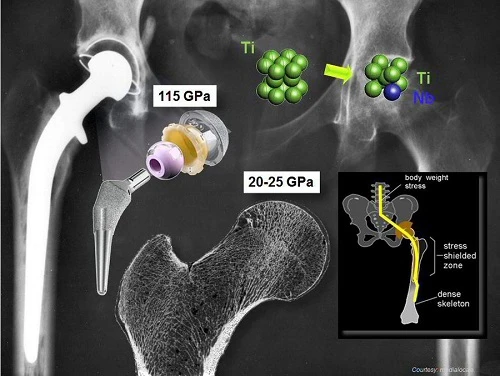 biomedical Ti biomedical Ti